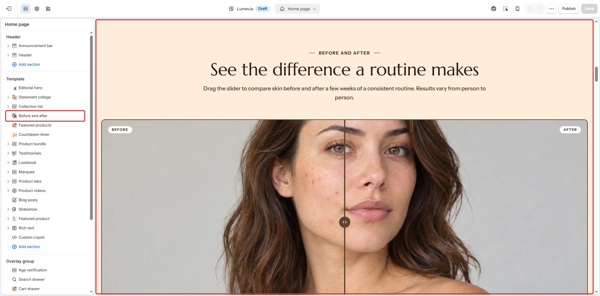 The Before and after section in the theme editor
