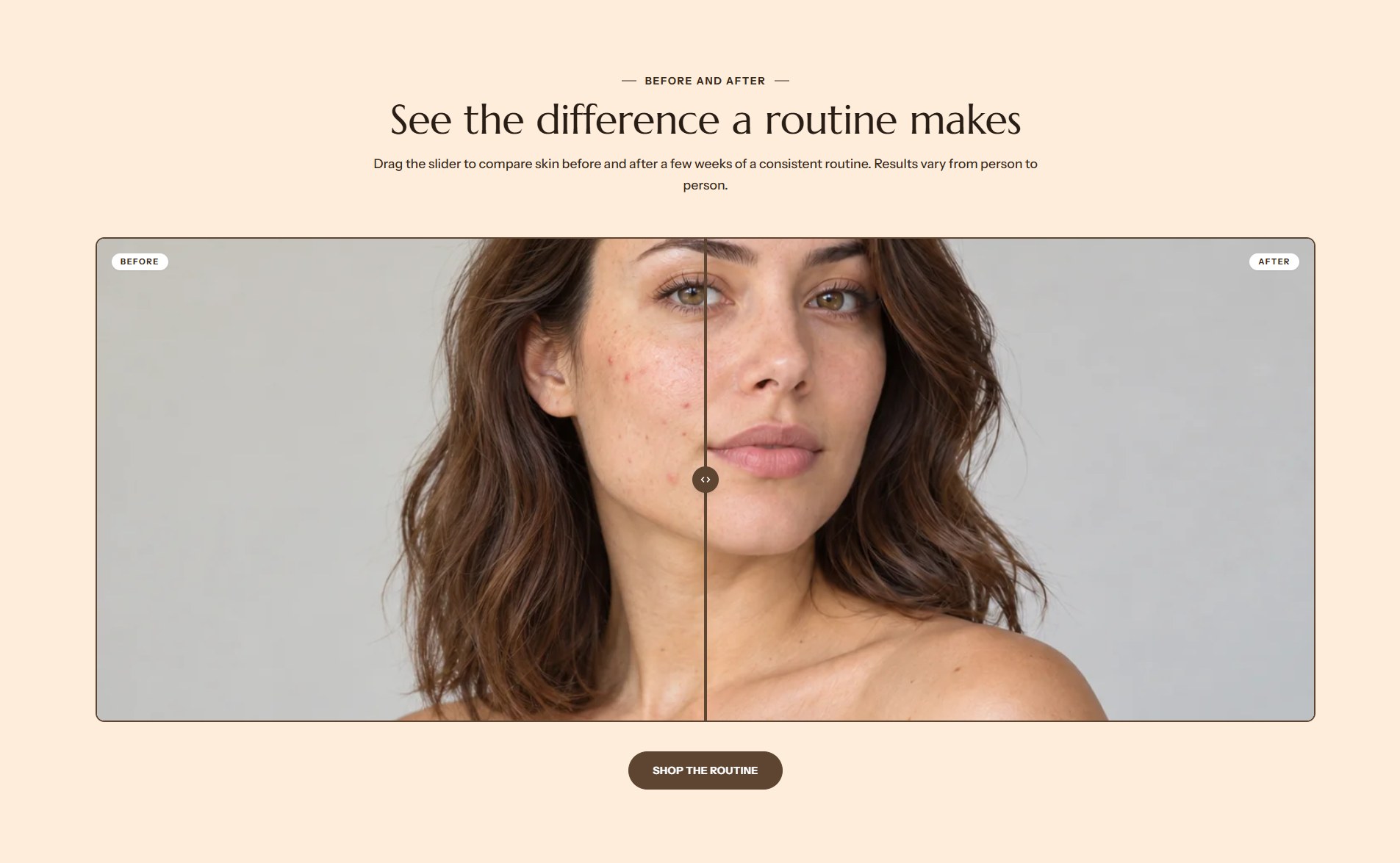 The Before and after section on the home page